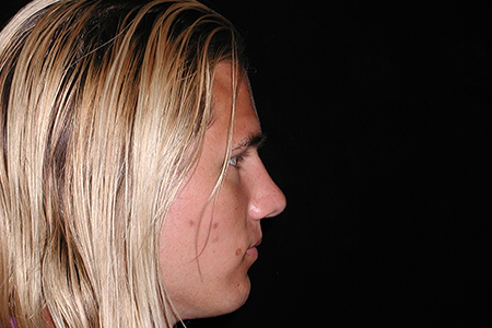 Original Image