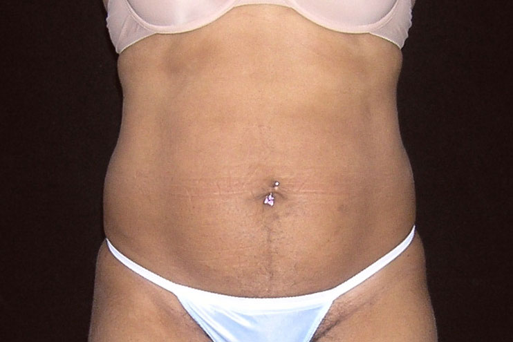 Original Image
