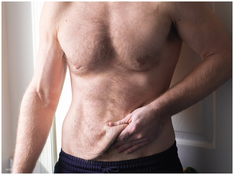 A fit, healthy man standing confidently, showcasing loose skin on his abdomen, a visible result of his significant weight loss. The image is used to highlight topics related to weight loss journeys and the physical changes that often accompany them, particularly in the context of weight loss surgery.