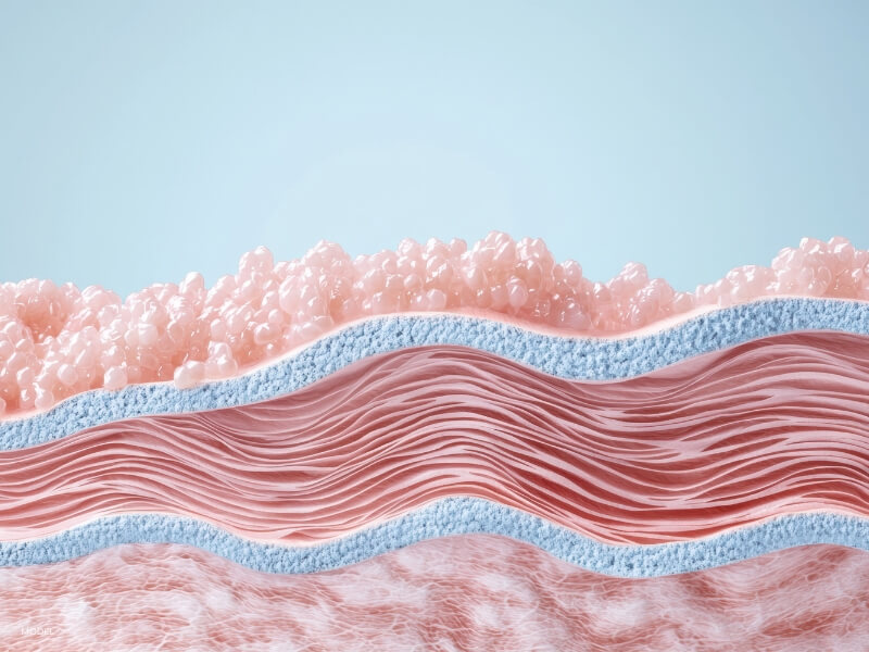 illustration of the layers of skin indicating the science of scarring